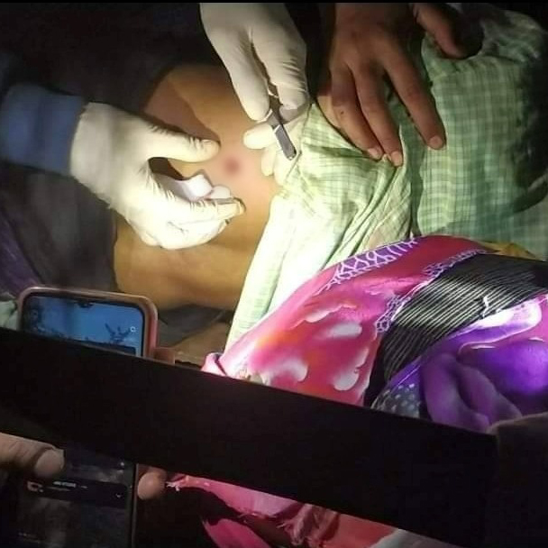 ခင်ဦးမှာ စစ်အုပ်စုကတိုက်ပွဲမဖြစ်ဘဲပစ်ခတ်လို့ အဘွားတဦးနဲ့အမျိုးသားတဦး ဒဏ်ရာရ