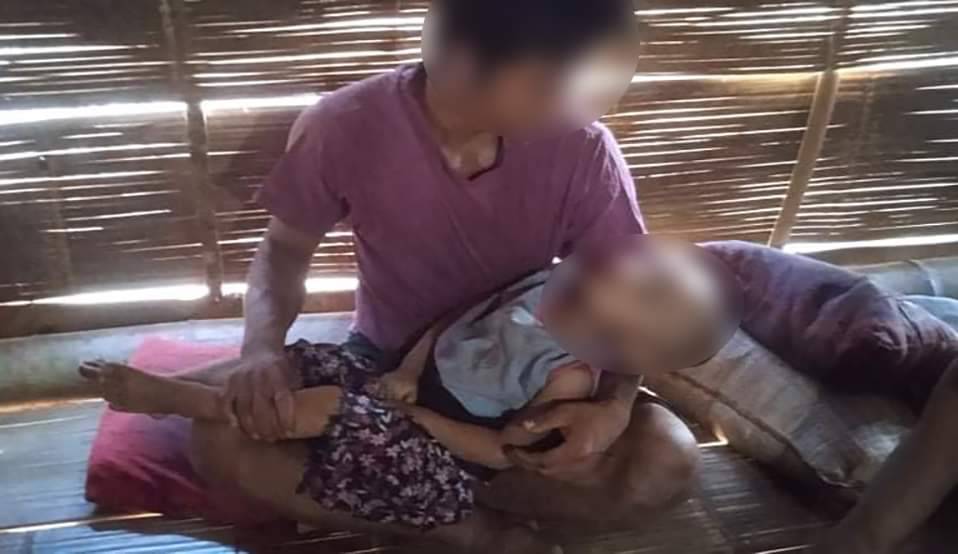 သံတောင်ကြီးမှာ လေယာဥ်နဲ့ဗုံးကြဲလို့ ကလေး ၁ ဦးသေပြီး ၃ ဦးဒဏ်ရာရ