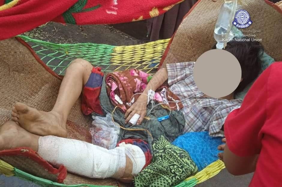 ကျောက်ကြီးမှာ စစ်တပ်ကလက်နက်ကြီးနဲ့ပစ်လို့ ကလေး ၁ ဦးအပါ ၂ ဦးသေဆုံး၊ KNU ရုံးကိုလည်း လေကြောင်းနဲ့ဗုံးကြဲ