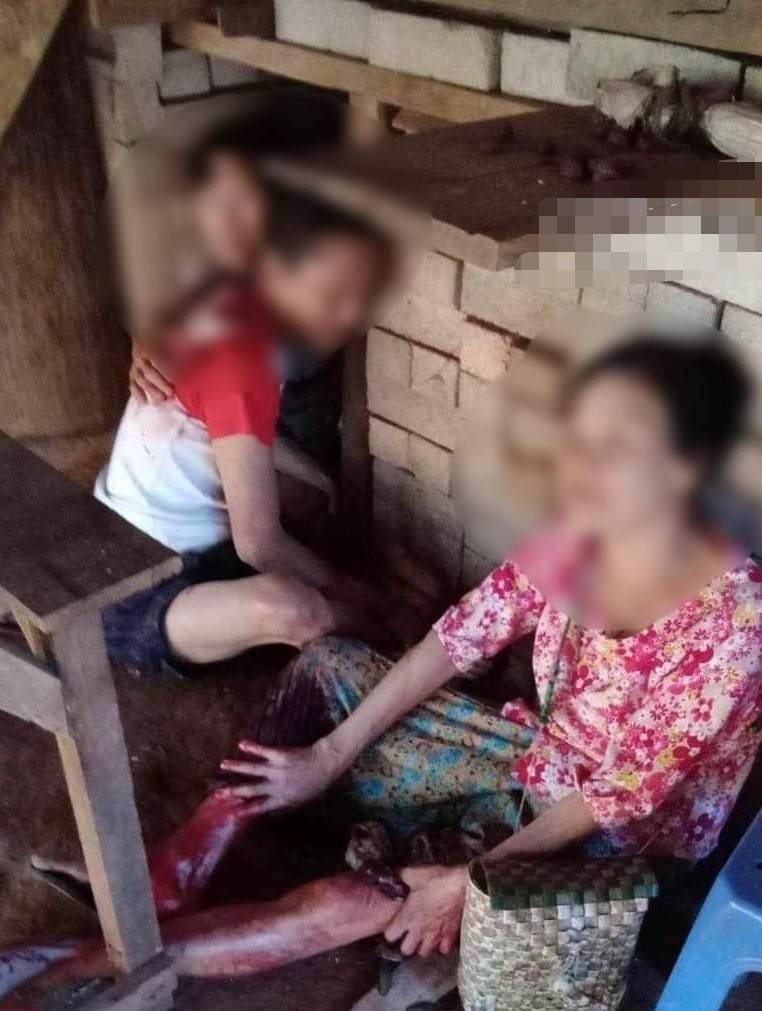 သံတောင်ကြီးတိုက်ပွဲ လက်နက်ကြီးထိလို့ ဒေသခံ ၅ ဦးဒဏ်ရာရ