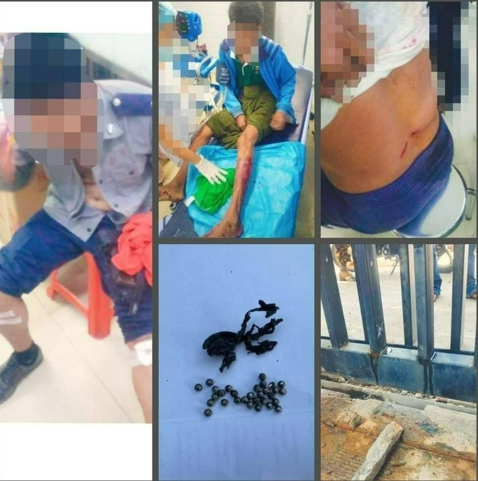 မန္တလာသီရိအားကစားကွင်းရှေ့က ရဲဂိတ်ဗုံးပစ်ခံရလို့ ၃ ဦး ဒဏ်ရာရ
