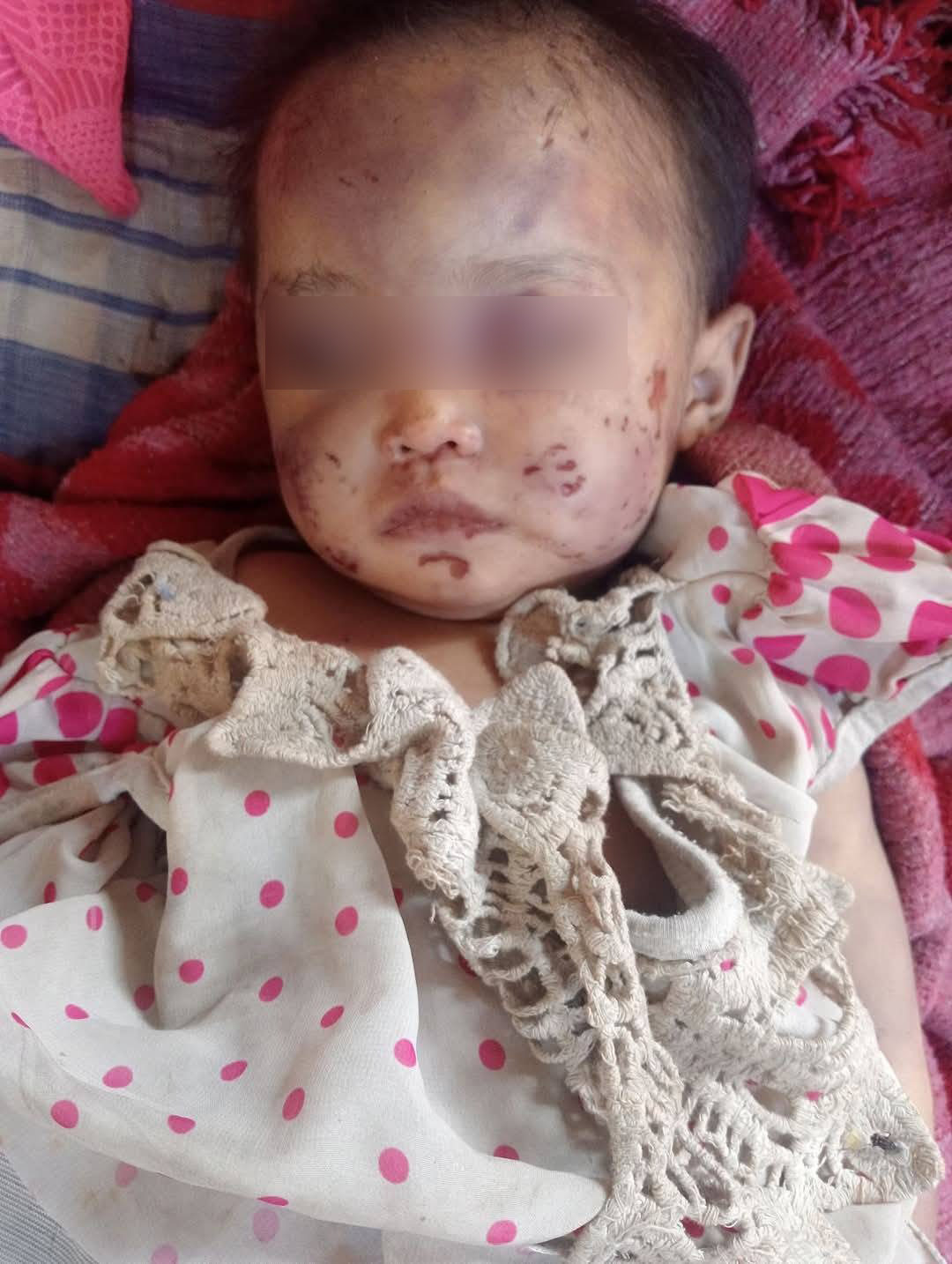 မိတ္ထီလာမှာ ရိုက်နှက်ဒဏ်ရာတွေရထားတဲ့ အသက် ၂ နှစ်အရွယ်မိန်းကလေး ၁ ဦးသေဆုံးသွားပြီး မိခင်နဲ့ပထွေးကို လူသတ်မှုနဲ့ရဲက ဖမ်းထား