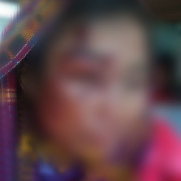ကြက်သွန်ခင်းမှာ မိုင်းပေါက်ကွဲလို့ အမျိုးသမီး ၁ ဦးသေဆုံးပြီး ၅ ဦးဒဏ်ရာရ